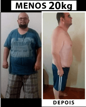 Imagem antes e depois de homem com perda de 20kg