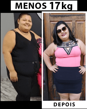 Imagem antes e depois de mulher com perda de 17kg